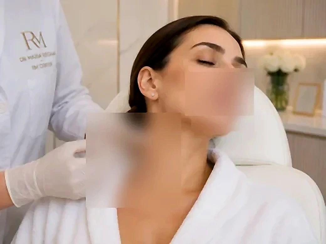 Botox du Cou - Dr Maria Reghai