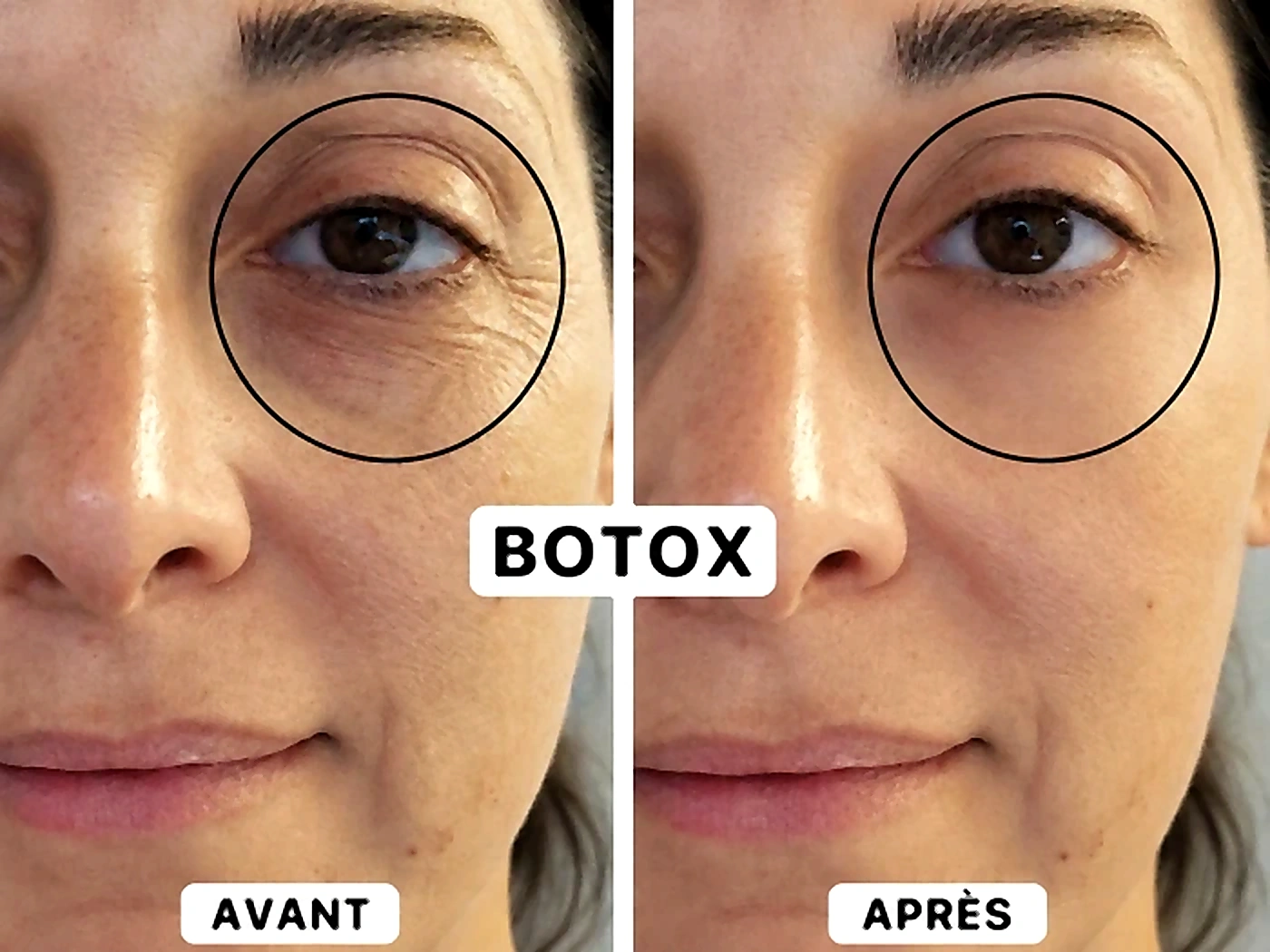 Injections - Dr Maria Reghai